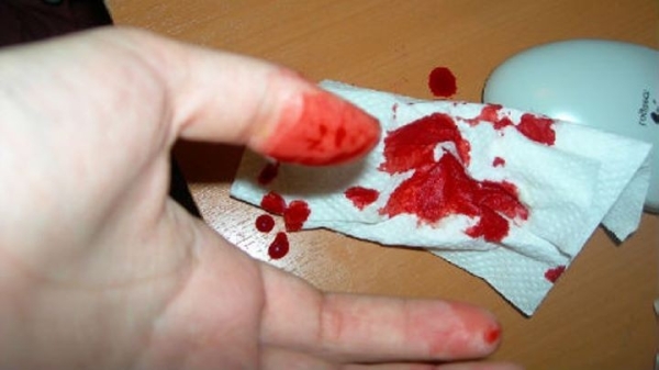 Житель Барановичей ударил родного брата ножом во время ссоры Житель Барановичей ударил родного брата ножом во время ссоры