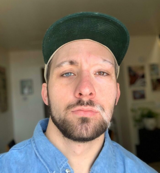 На этих фото показали, какие финты генетика вытворяет с людьми На этих фото показали, какие финты генетика вытворяет с людьми