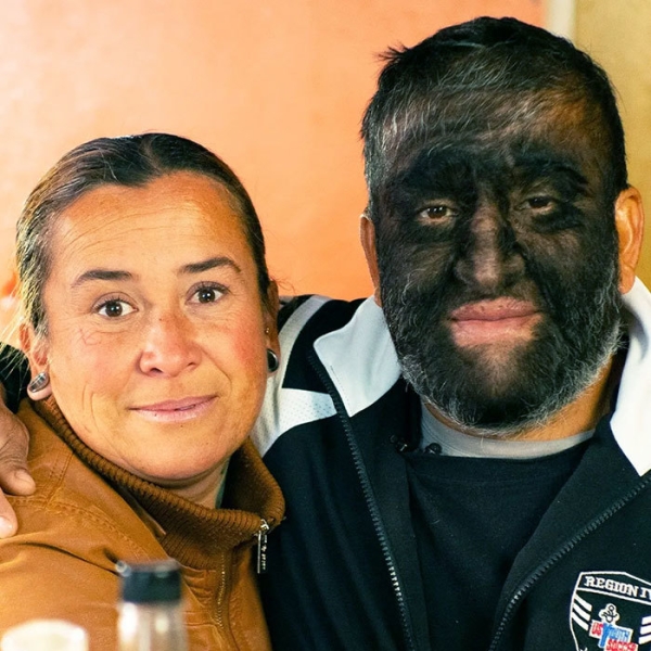 На этих фото показали, какие финты генетика вытворяет с людьми На этих фото показали, какие финты генетика вытворяет с людьми