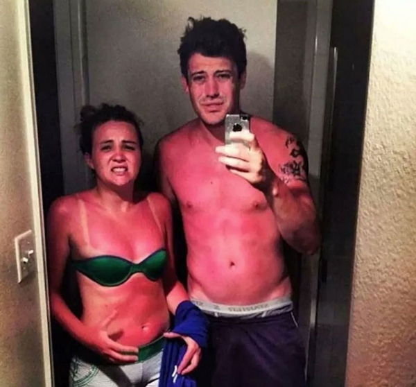 Эти фотографии показали, почему использовать солнцезащитный крем — хорошая идея! Эти фотографии показали, почему использовать солнцезащитный крем — хорошая идея!