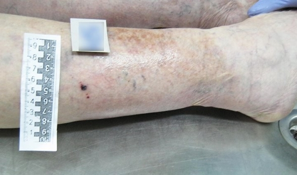 В Беларуси змея укусила на даче пенсионерку. Она умерла В Беларуси змея укусила на даче пенсионерку. Она умерла