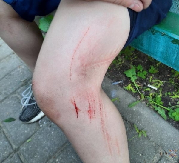 В Беларуси работники МЧС помогли мальчику, который застрял в приямке В Беларуси работники МЧС помогли мальчику, который застрял в приямке