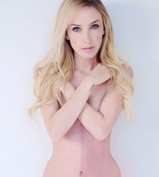 На этих фото показали, какие финты генетика вытворяет с людьми На этих фото показали, какие финты генетика вытворяет с людьми