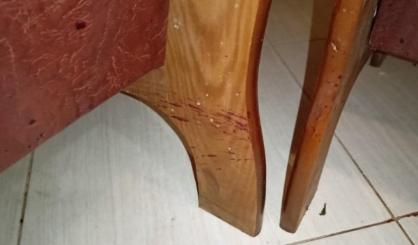 Избил, поджег, а после пытался закопать в погребе. Убийство с особой жестокостью произошло в Беларуси Избил, поджег, а после пытался закопать в погребе. Убийство с особой жестокостью произошло в Беларуси